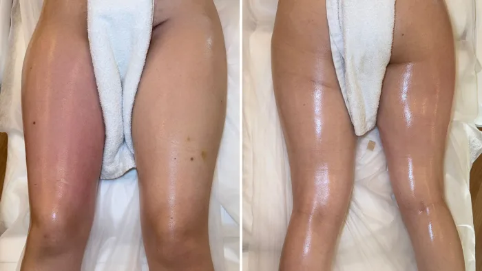 Masaje detox en Barcelona