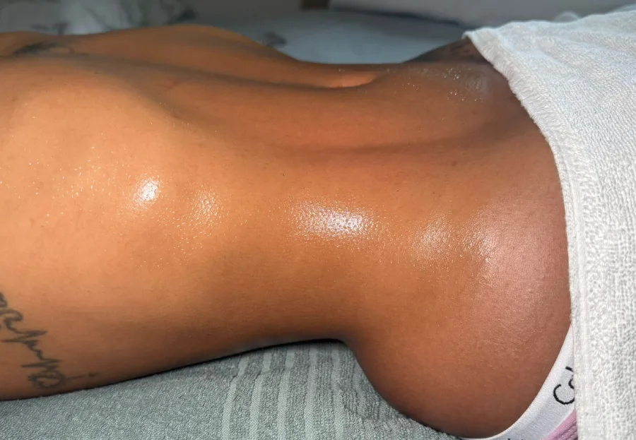 Masajes post-operatorios en Barcelona, la clave contra la fibrosis