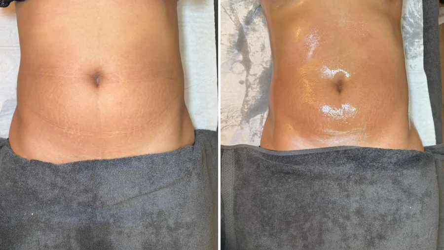 Método Thais Leon, ¡esculpe tu figura y tu contorno corporal!