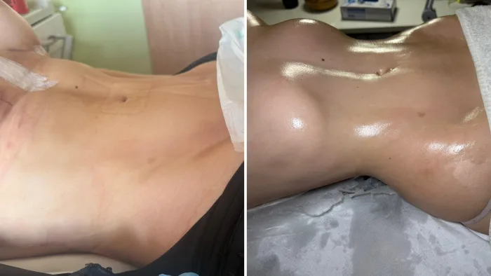 ¿Preparada para tu cirugía? Lo que nadie te dice sobre el pre-operatorio